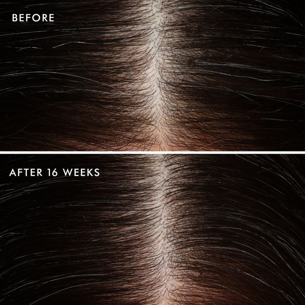 Moroccanoil Revitalizing Scalp Tonic 100ml